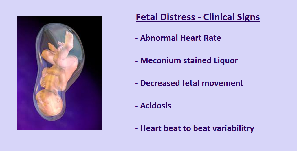 Fetal Distress in labour - why does it occur?
